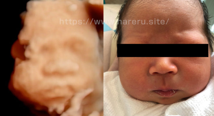画像あり エコーと実際の赤ちゃんはどのぐらい違う いずれは晴れる
